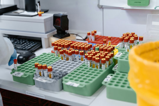 Specimen Pickup